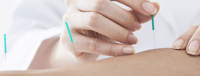 kursus i advanced dry needling